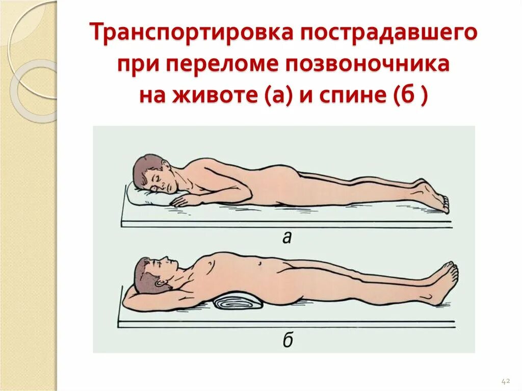 Как транспортировать пострадавшего с повреждением позвоночника