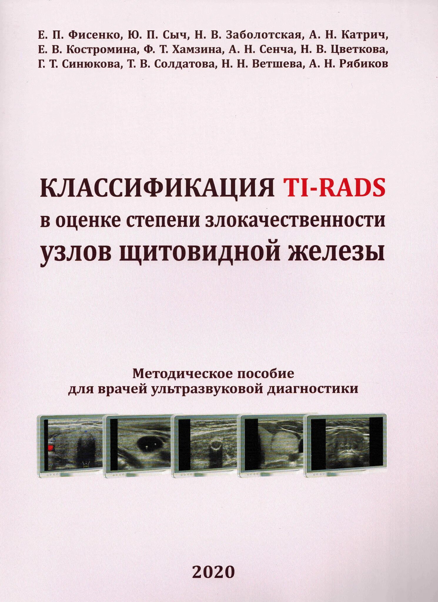 Ti rads 3 в щитовидной. Классификация Tirads щитовидная железа УЗИ. Тирадс классификация узлов щитовидной. Ti rads классификация. Узлы щитовидной железы классификация по УЗИ.