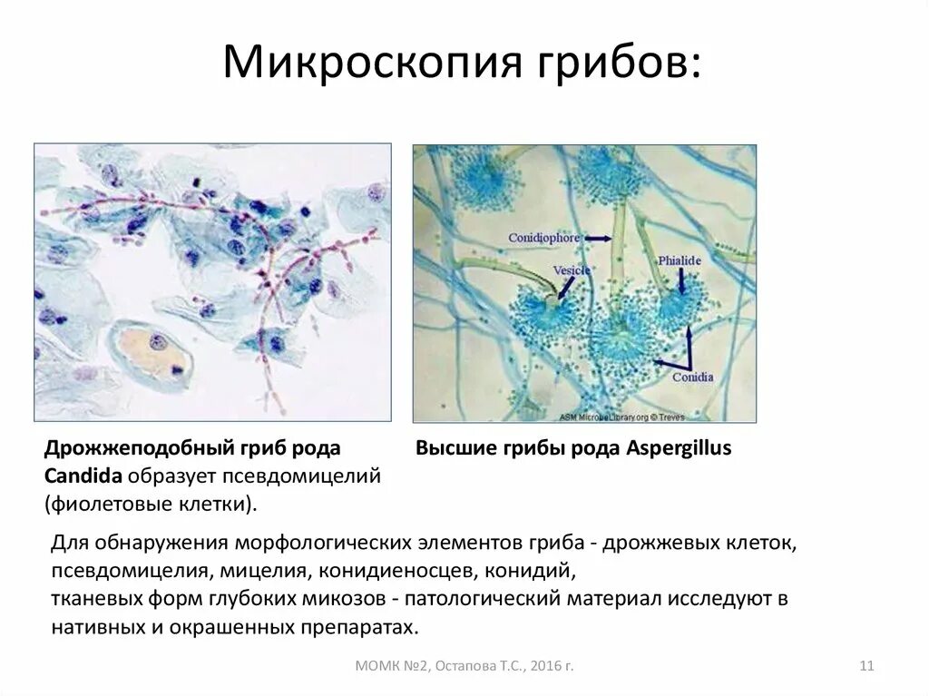 Обнаружены споры и мицелий. Псевдомицелий кандида. Грибы кандида микроскопия. Микроскопия кандиды псевдомицелий. Грибы рода кандида микроскопия.