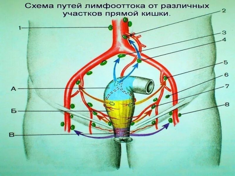 Схема прямой кишки. Лимфоотток от прямой кишки. лимфатические узлы от прямой кишки. лимфоотток от прямой кишки анатомия. регионарные лимфоузлы прямой кишки.