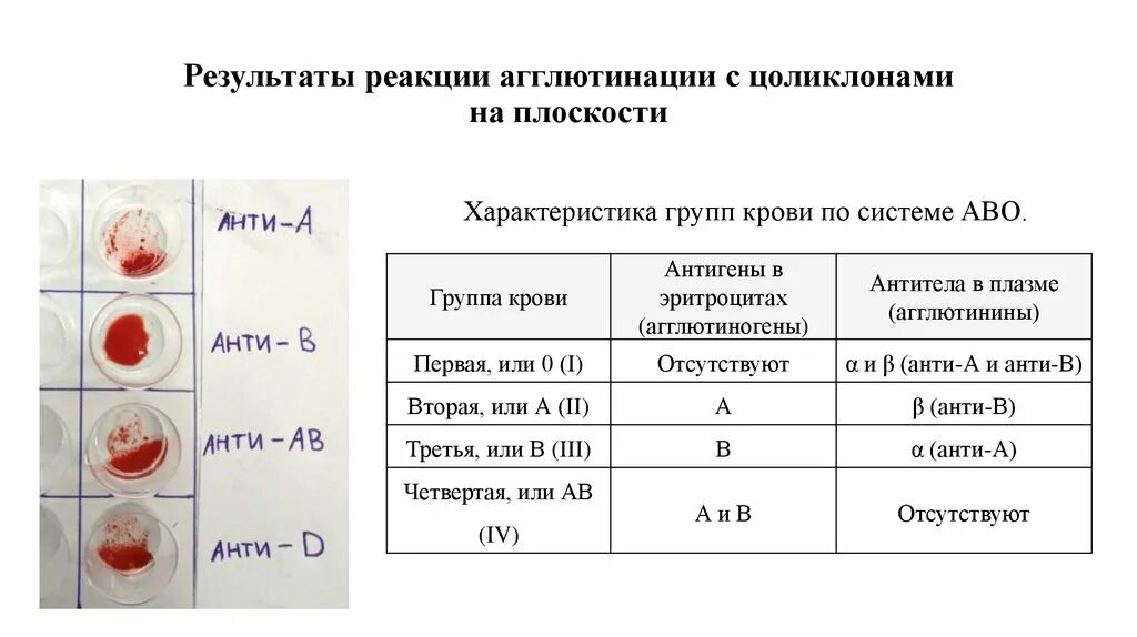 Резус фактор цоликлонами таблица. Цоликлоны для определения группы крови таблица. Определение группы крови агглютинация таблица. Реакция агглютинации для определения резус фактора. С группой крови пациента