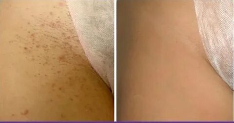 Денедегі порно қыздар