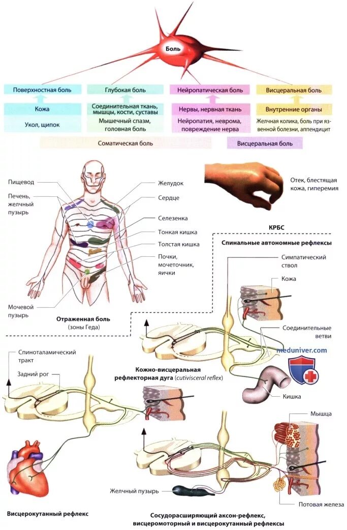 Характер неврологической боли. Висцеральные органы. Боль неврология. Висцеральная система человека. Висцеральные органы человека.