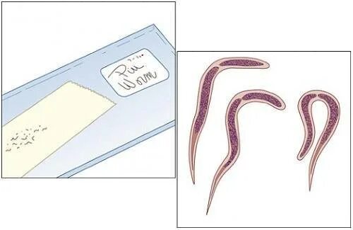 Скотч глисты. Мазок на энтеробиоз у детей. Соскоб на энтеробиоз (яйца остриц).