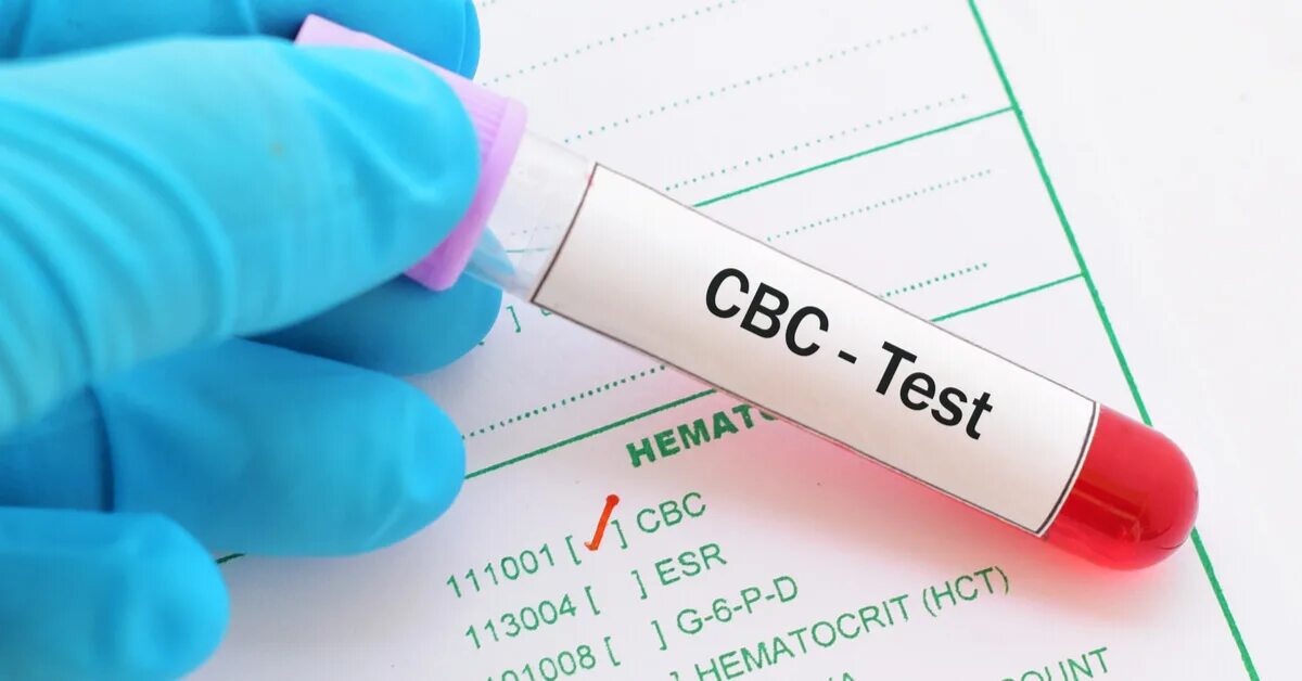 Склеивание крови. Исследование крови рисунок. Blood count. Blood Analysis. HCT тест.