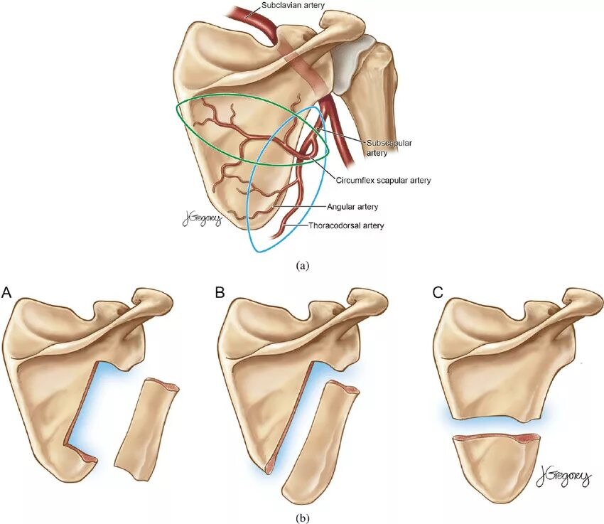 A circumflexa scapulae. Scapula flap. scapular flap. musculi scapulae.