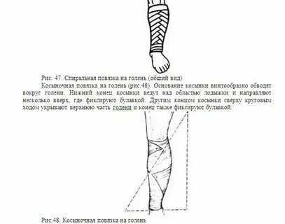 Повязка при ранении голени