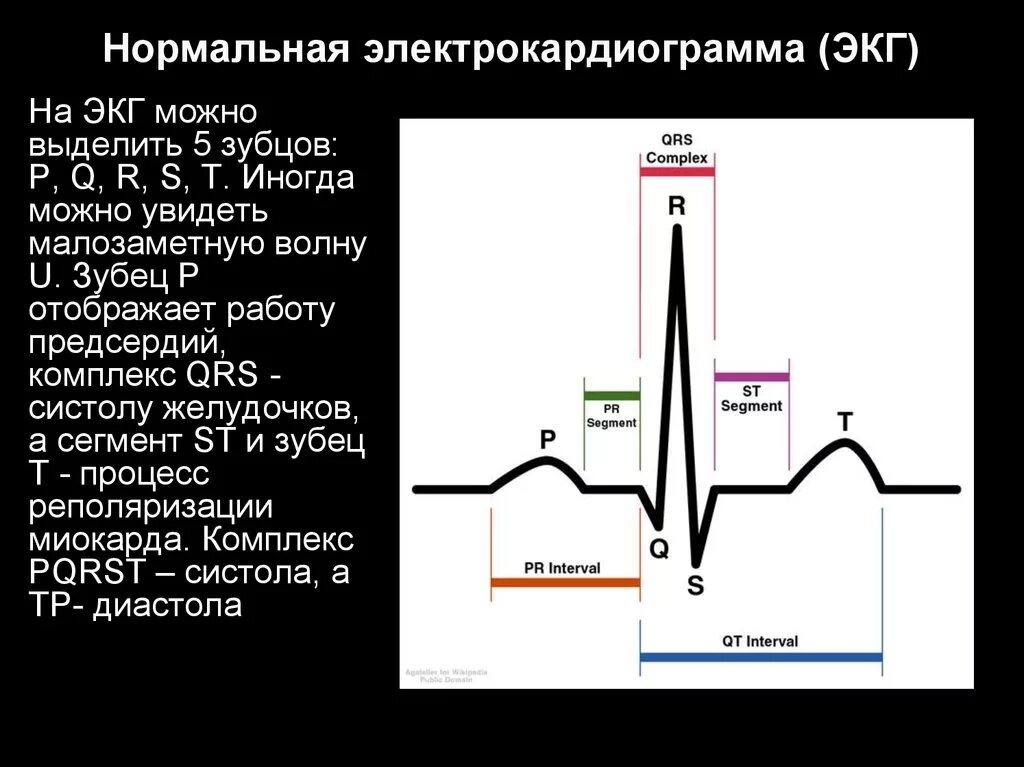 Нарастание зубца. Комплекс QRS на ЭКГ норма. Комплекс PQRST на ЭКГ. Комплекс зубцов QRS на ЭКГ. ЭКГ без комплекса QRS.