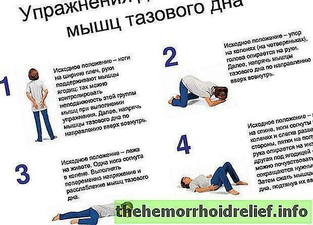 Можно ли при геморрое заниматься анальным. Гимнастика кегеля для женщин при геморрое. гимнастика кегеля для мужчин при геморрое. упражнения при геморрое для мужчин. упражнение кегеля при геморрое у женщин.