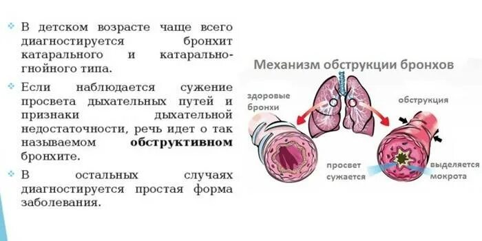 Бронхит с синдромом бронхиальной обструкции у детей. При обструктивном бронхите у детей развивается дыхание. Механизм обструкции бронхов у детей. Острый бронхообструктивный бронхит.