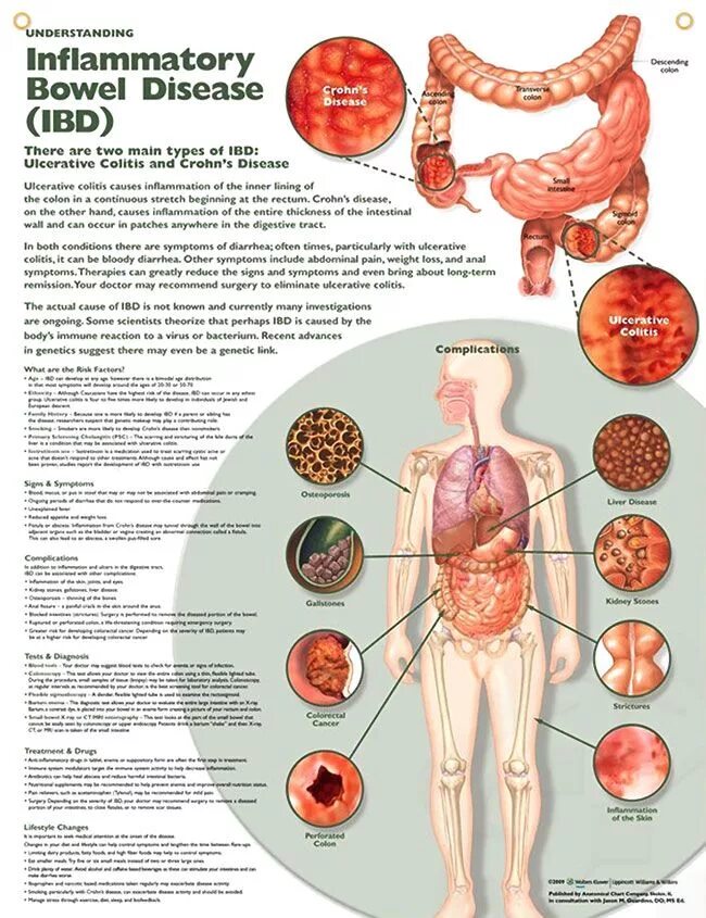 Bowel disease. Заболевания органов пищеварения. Заболевания органов пищеварения. Bowel disease. Bowel disease.