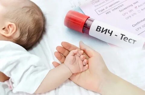 Вич инфекция новорожденных