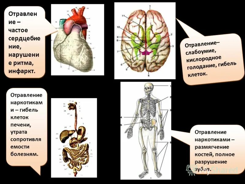 Кислородное голодание мозга симптомы у взрослых. Рисунок по ОБЖ 6 класс кислородное голодание.