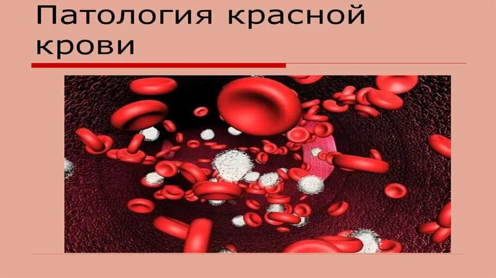 Презентация почему кровь красная. Почему кровь красная у человека. Почему кровь красного цвета.