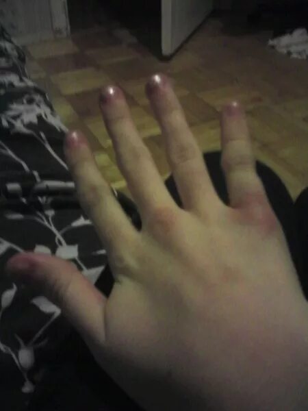 девушка ломает пальцы. жесты руками.