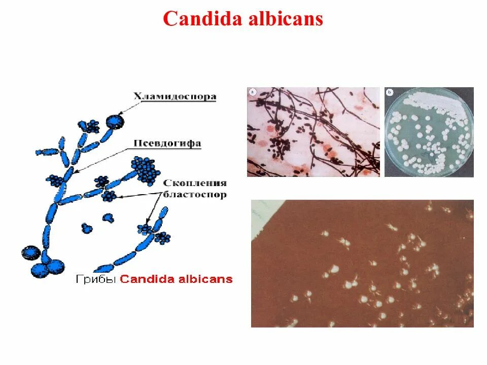 Патогенные грибы споры. Грибы рода кандида альбиканс. Дрожжеподобные грибы рода кандида. Грибы рода Candida микробиология. Грибы аспергилл кандида.