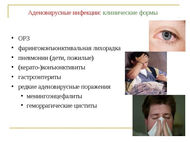 Метапневмовирусная инфекция у взрослых симптомы. Аденовирусная инфекция, фарингоконъюнктивальная лихорадка синдромы. клинические симптомы аденовирусной инфекции. клинические симптомы при аденовирусной инфекции.
