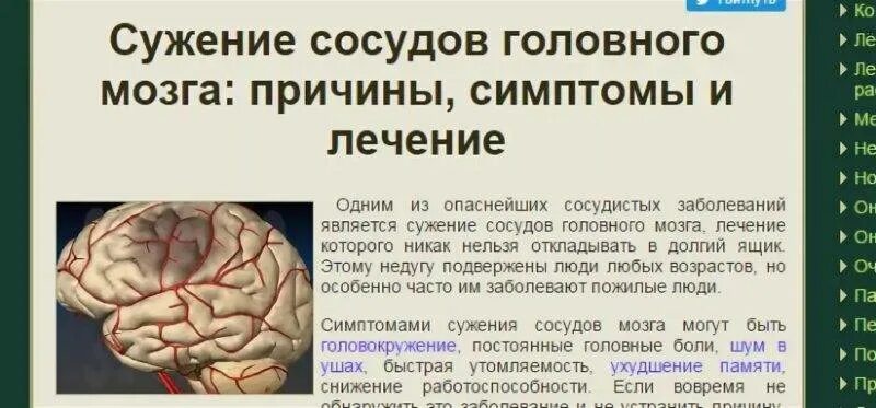 Почему мозг хуже. Сужение сосудов головного мозга. Сосуды головного мозга сужены. Сужение и расширение сосудов головного мозга. Сужение сосудов головного мозга симптомы и причины.