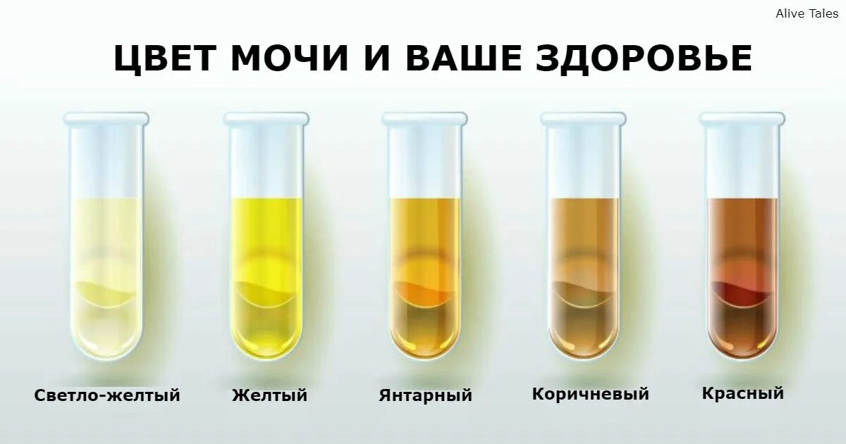 Почему моча изменяется. Цвет мочи. Желтый цвет мочи. Нормальный цвет мочи. Нездоровый цвет мочи.