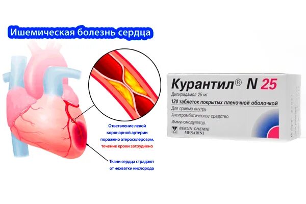 Таблетки от ишемии. Препараты при ишемической болезни сердца лекарственные препараты. Лекарство от ишемической болезни сердца. Таблетки при ишемической болезни сердца. Препараты применяемые при ишемической болезни сердца.