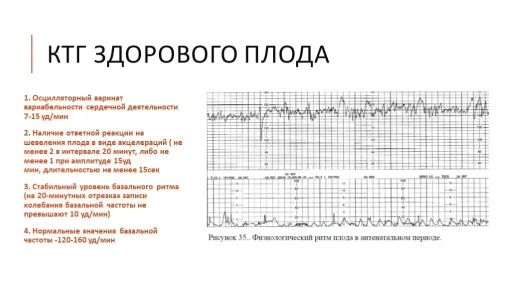 Сердцебиение плода ктг