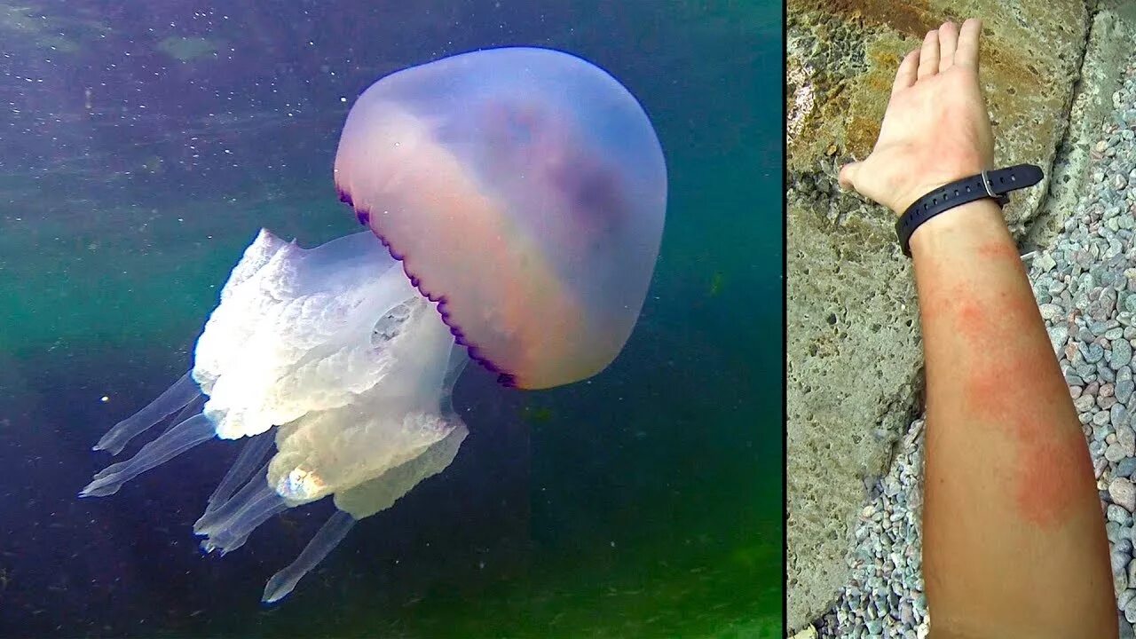 Чем опасны медузы. Медуза корнерот в черном море. Медуза корнерот большая. Корнерот медуза в черном. Корнерот Черноморский.