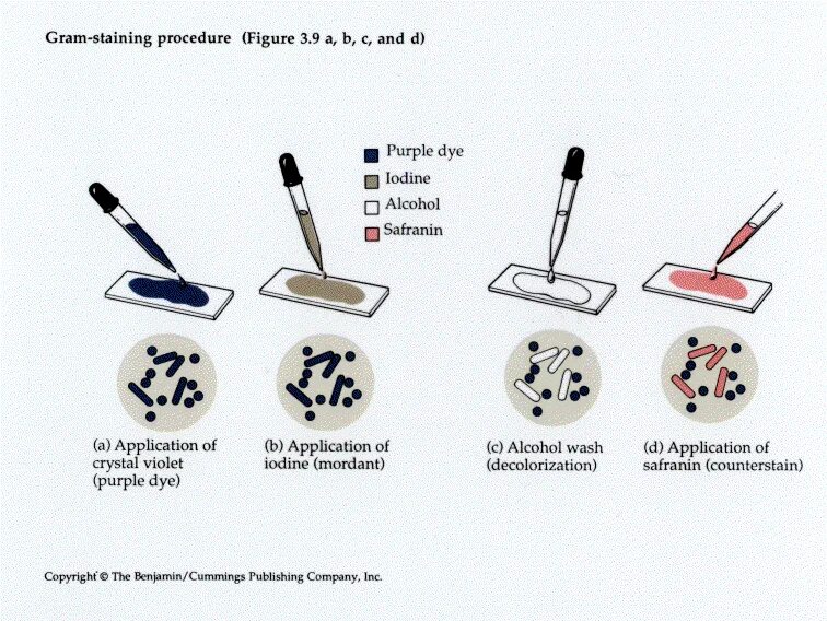 50 methods. Gram staining of bacteria. Метод грама. Грам положительный и отрицательный. Смесь по Граму 2.