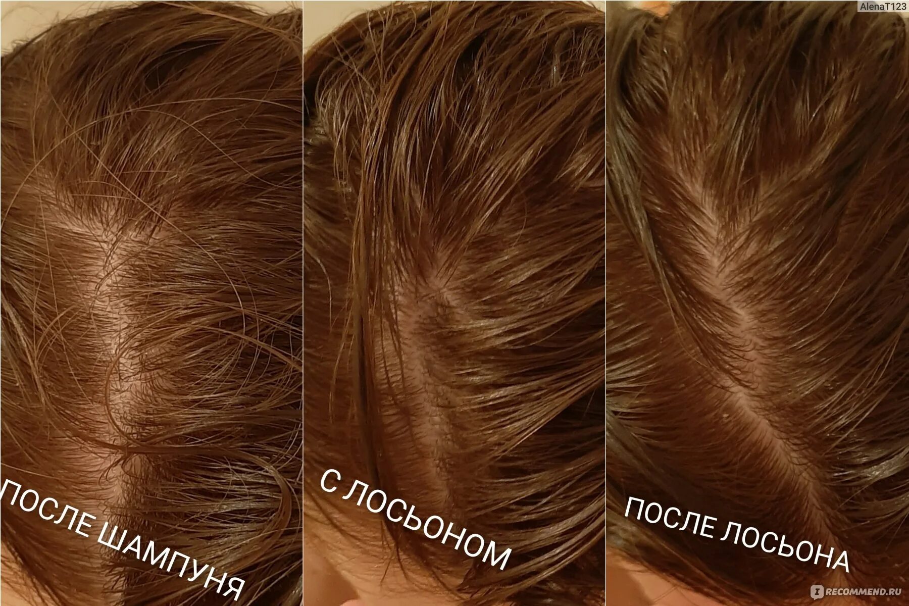 Scalp spa cleansing lotion. Scalp spa cleansing lotion