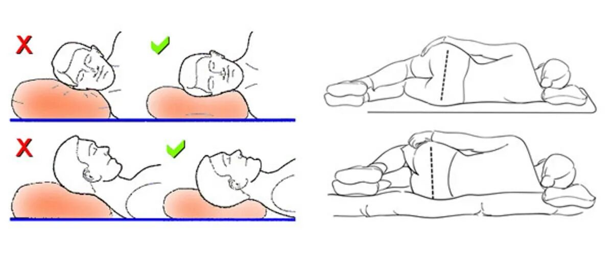 Правильная поза для сна. Правильное положение для сна. Правильное проожения для сна. Правильная поза для сна на боку. Что будет если спать на боку
