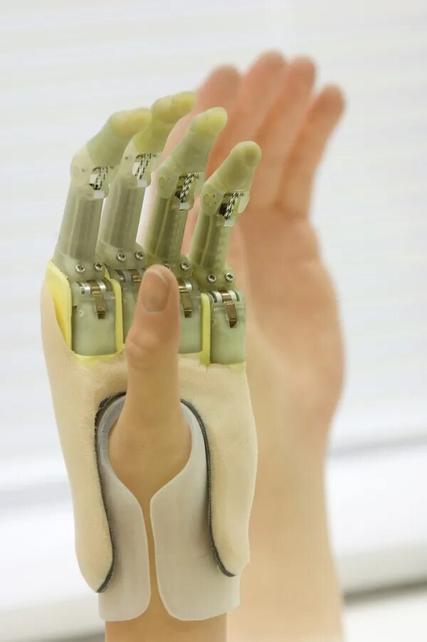 Механический протез пальца. Самодельный протез руки. Протез указательного пальца. Механический протез пальца. Бионические протезы пальцев рук.