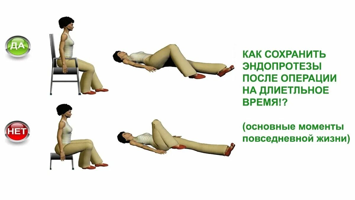 Как спать после эндопротезирования тазобедренного. Комплекс упражнений после эндопротезирования тазобедренного. Лечебная гимнастика после операции тазобедренного сустава. Кровать после эндопротезирования тазобедренного. Реабилитация после эндопротезирования ТБС.