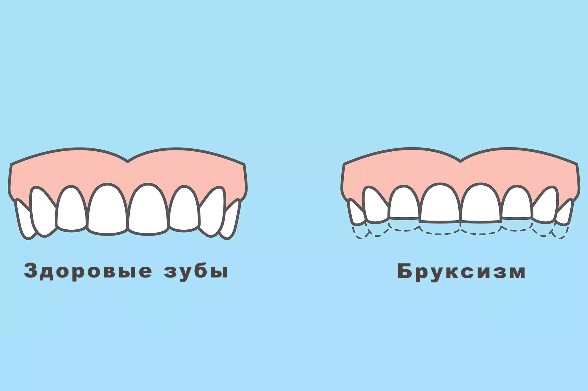 Щелкаю зубами во сне. Щелкаю зубами во сне. Ребёнок скрипит зубами ночью во сне. Щелкаю зубами во сне. Человек ночью скрипит зубами.