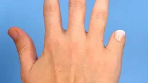 Short fingered