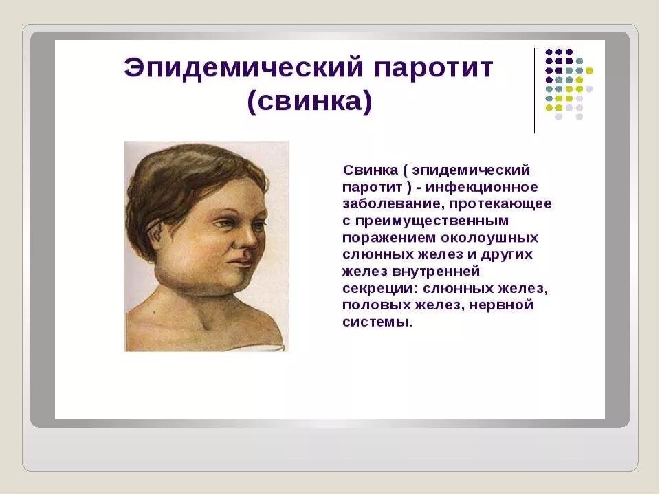 Эпид паротит у детей. Свинка эпидемический паротит клиника. Эпидемический паротит контагиозность. Эпидемиологический паротит возбудитель.