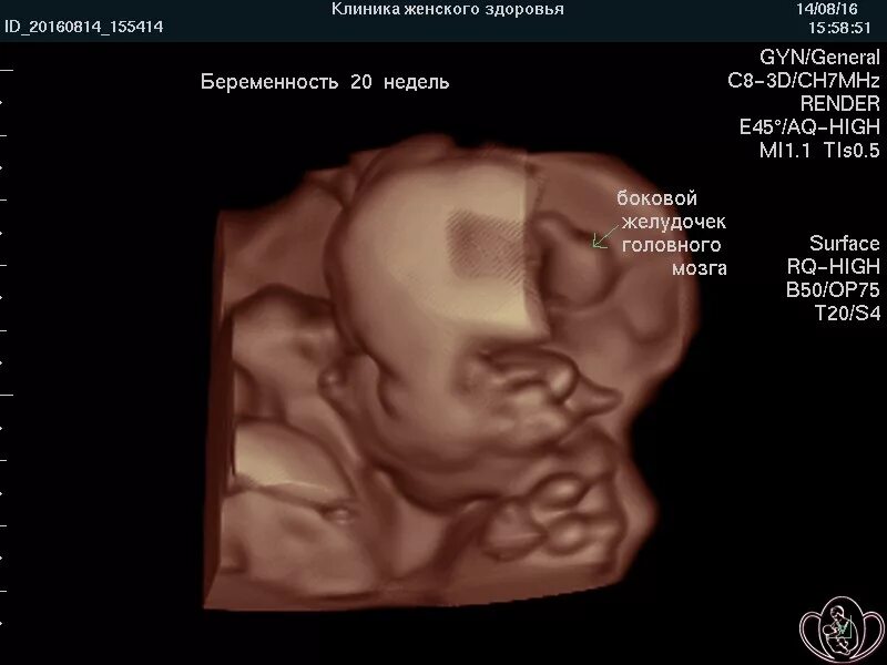 Сколько будет дней 20 недель. Эмбрион 20 недель размер вес. Размер эмбриона на 20 неделе беременности. Размер ребенка на 20 неделе. 20 Недель беременности размер плода.