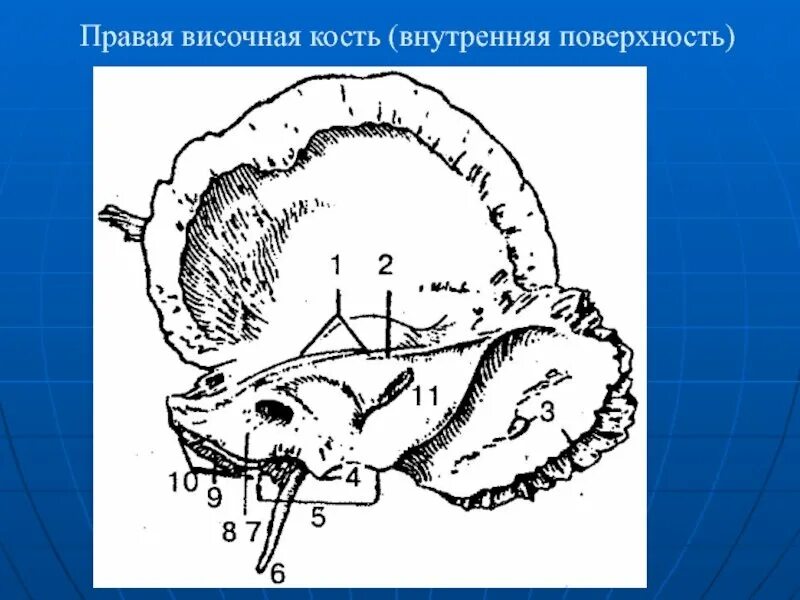 Височная кость черепа анатомия. Височная кость анатомия Синельников. Борозда Нижнего Каменистого синуса височная кость. Височная кость улитка. Изменения височной кости