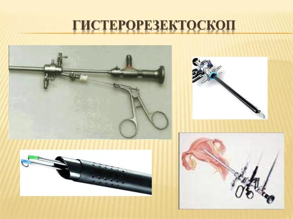 Гистероскоп и гистерорезектоскоп. Гистерорезектоскоп q4027h. Гистерорезектоскопия полипэктомия. Инструменты для гистерорезектоскопии.