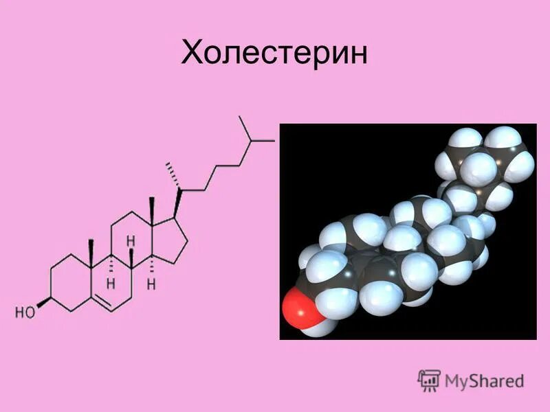 Холестерин триглицериды. Холестерин. фосфолипиды и холестерин. липиды триглицериды холестерин. форма кристаллов холестерина.