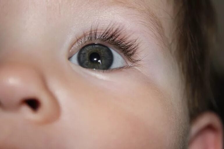 Почему у новорожденного глазки. Гетерохромия у новорожденных. Глаза у новорожденных. Цвет глаз у новорожденных. Серо-карие глаза у ребенка.