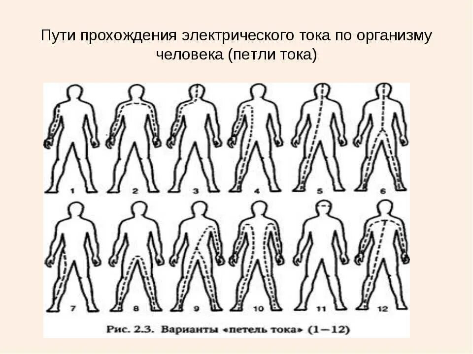 Пути поражения током. Пути прохождения электрического тока через организм человека. Путь тока через тело человека. Пути прохождения тока через тело человека. Пути прохождения электрического тока через тело.