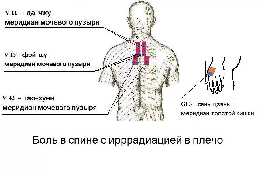 Точечная боль в позвоночнике. Точечно болит спина. Меридиан мочевого пузыря.