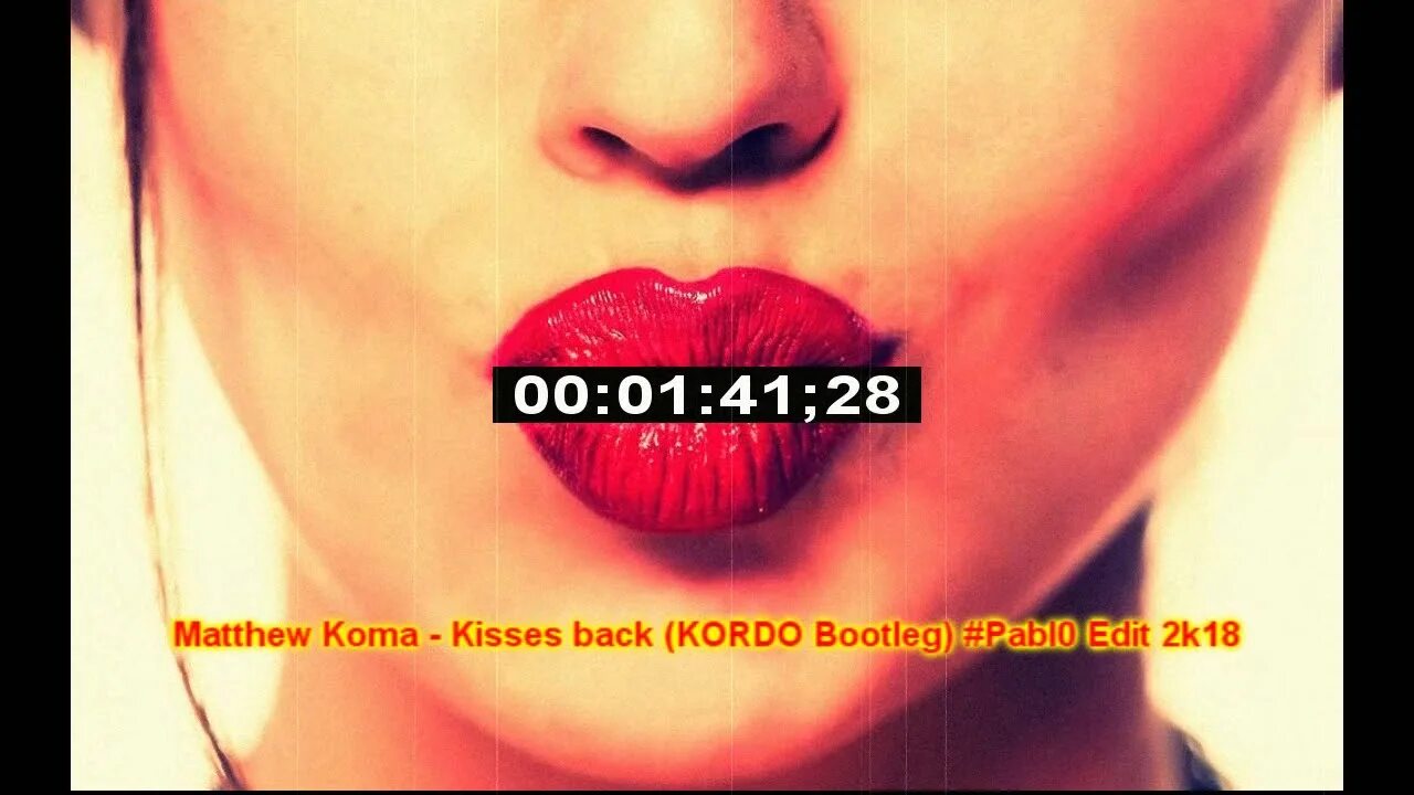 Мэтью кома Kisses back. Matthew Koma - Kisses back. Matthew Koma Kisses back Anthony Keyrouz Remix 2021. Kisses back девушки. Matthew koma back