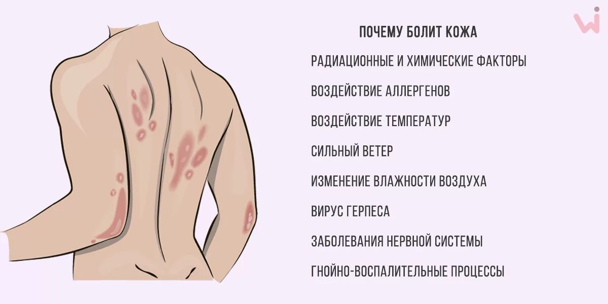 Высыпания на коже больные. Кожные высыпания на спине. Болит кожа на теле причины