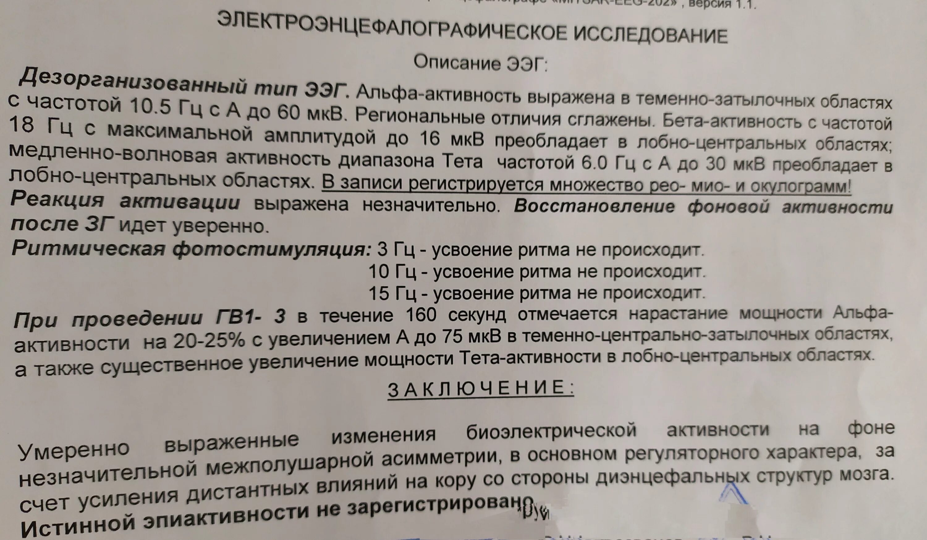 Ээг индексы. Заключение ЭЭГ. Нормальное заключение ЭЭГ. ЭЭГ расшифровка. Примеры ЭЭГ С расшифровкой.