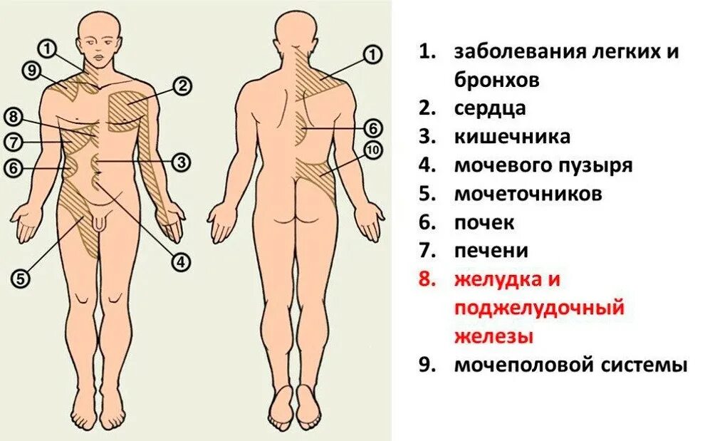 Зоны Захарьина-Геда схема. Зоны гиперчувствительности Захарьина-Геда. Зоны кожной гиперестезии Захарьина Геда. Зоны Захарьина Геда зоны отраженных болей. Повышенная чувствительность латынь