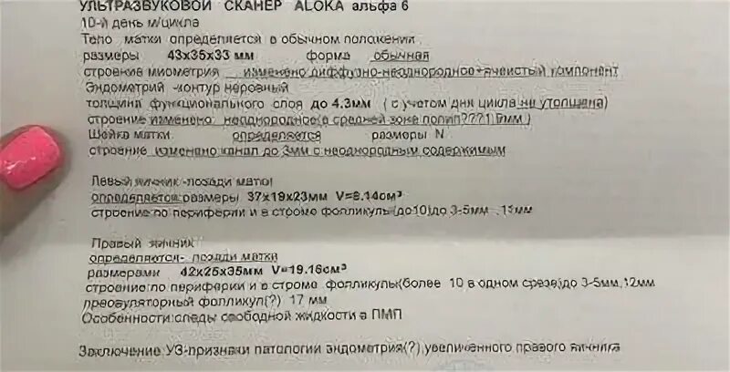 20 день цикла форум