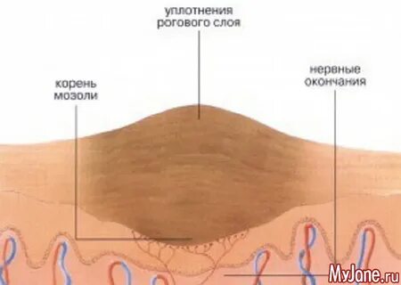 Подкожный корень