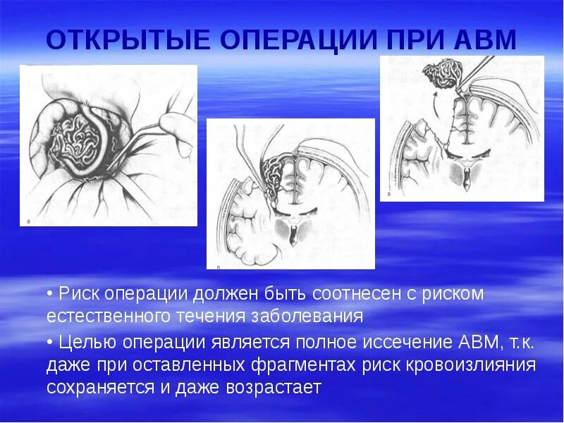 Комбинированной операцией следует считать