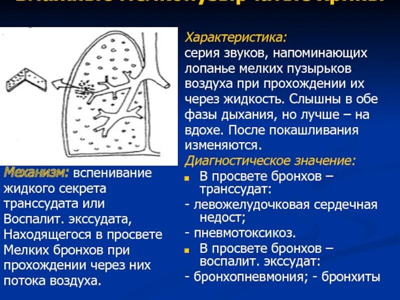 Лопающиеся пузырьки при дыхании. Влажные мелкопузырчатые хрипы. При вдохе звук в легких. Рассеянные мелкопузырчатые хрипы. Механизм мелкопузырчатых хрипов.