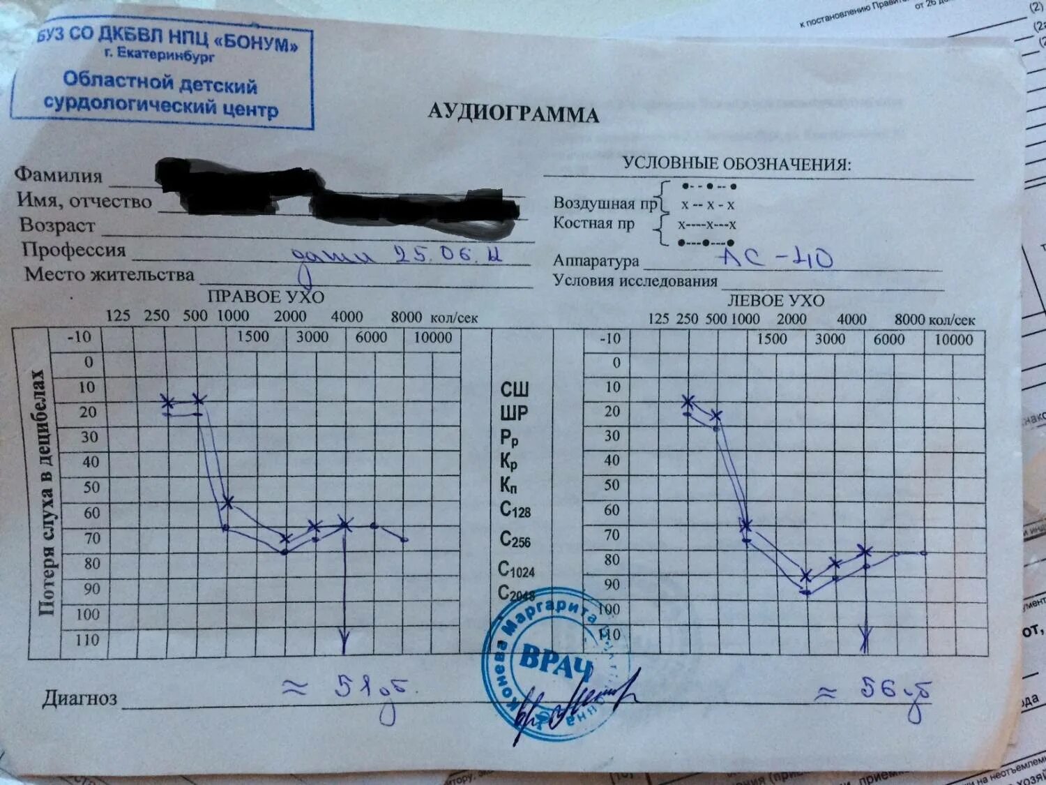 Тугоухость какая инвалидность